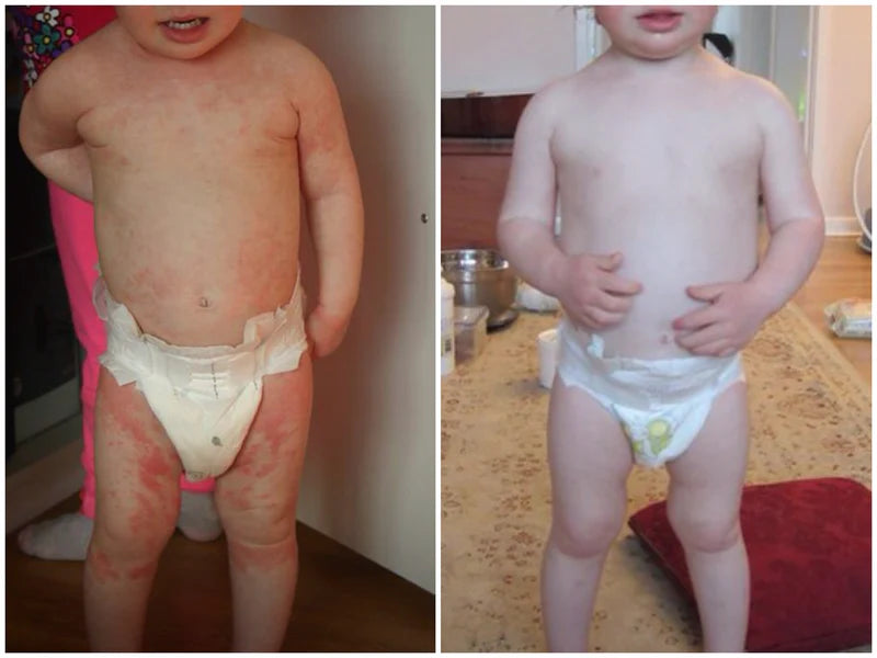 Verda Natural Relief Blend