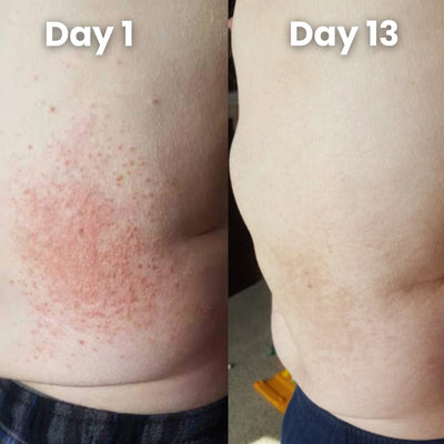 Verda Natural Relief Blend