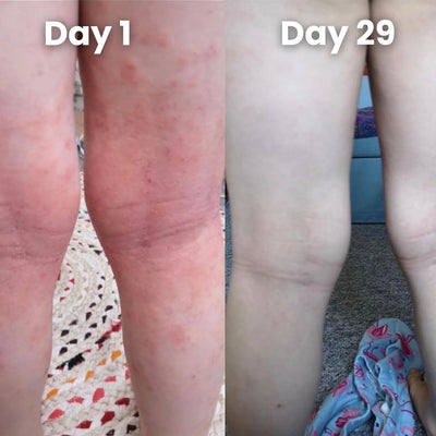 Verda Natural Relief Blend